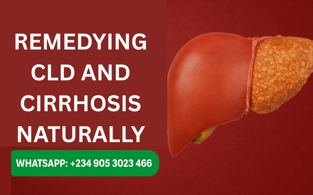 Natural Remedies for Chronic Liver Disease (CLD) and Cirrhosis in Nigeria: A Herbal Pathway to Liver Repair